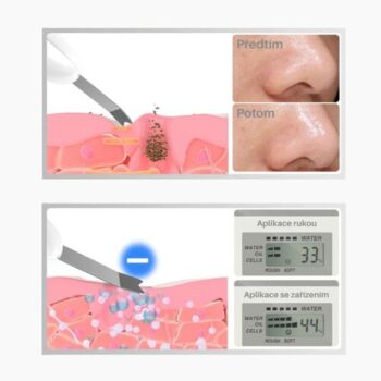 TOUCHBeauty 1887 ultrazvuková špachtľa na pleť