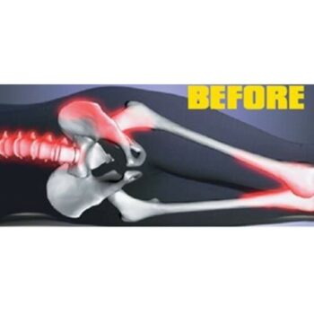 Vankúš medzi kolená, 26 x 21 x 16 cm