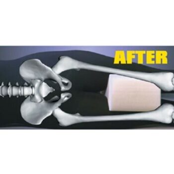 Vankúš medzi kolená, 26 x 21 x 16 cm